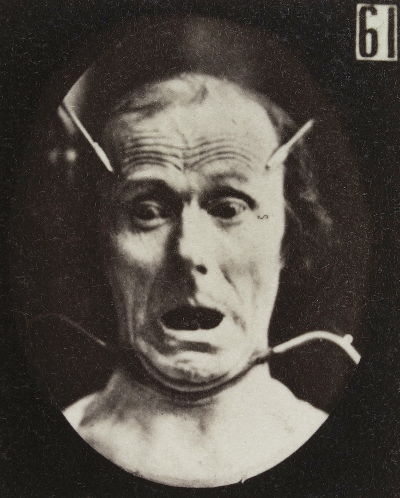Illustration for article titled Terrifying, Century-Old Photographs from Neuroscience Experiments